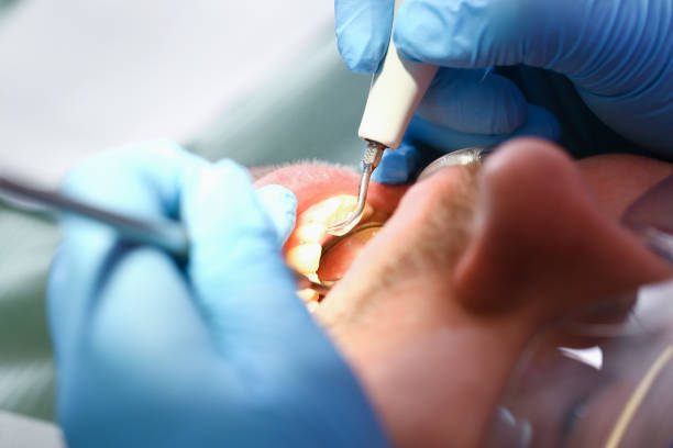 Best Pediatric Emergency Dentist in Forsgate, NJ