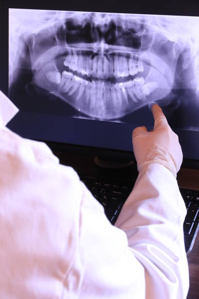 Best Emergency Dental Extractions in Forsgate, NJ