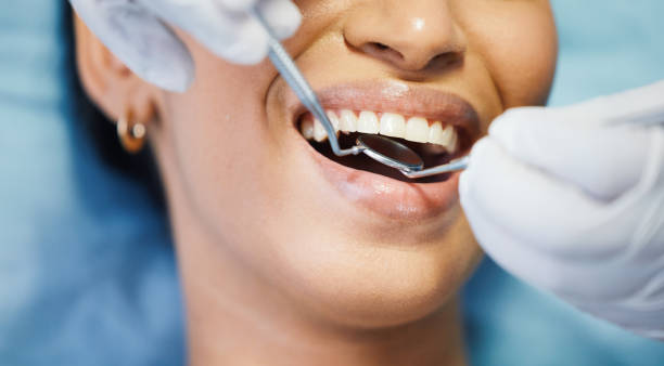 Best Emergency Dental Extractions in Forsgate, NJ