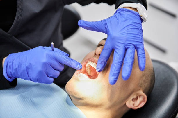 Best Urgent Dental Care for Toothache in Forsgate, NJ