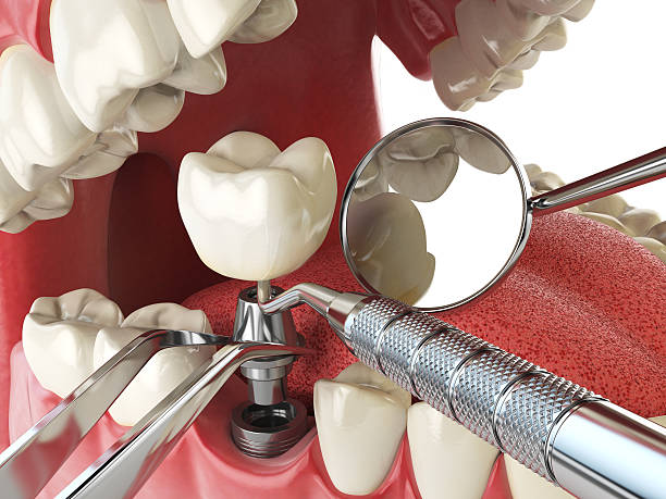 Best Emergency Dentist for Special Needs Patients in Forsgate, NJ